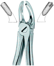 Upper Molars Left Tooth Ext Forceps